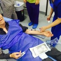 2 implantes en el sector anterior con injerto óseo 3