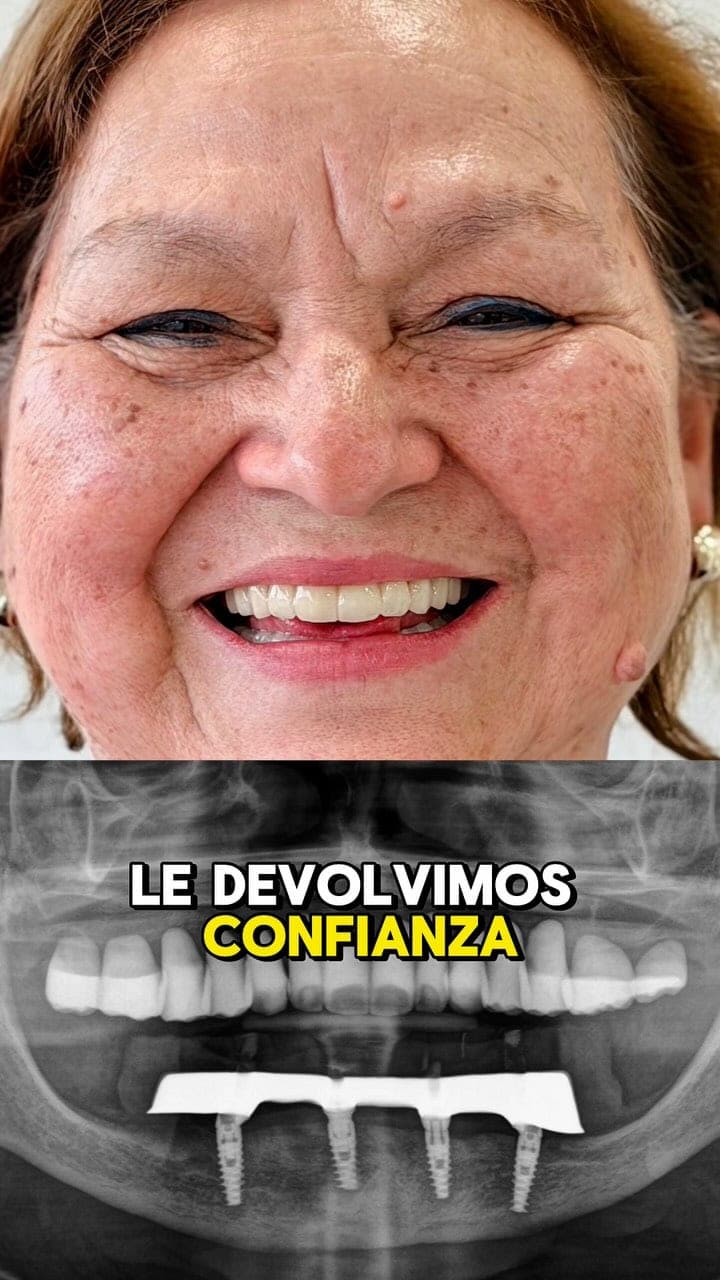 Historia de rehabilitación de María Elena en Clínica Sonríe