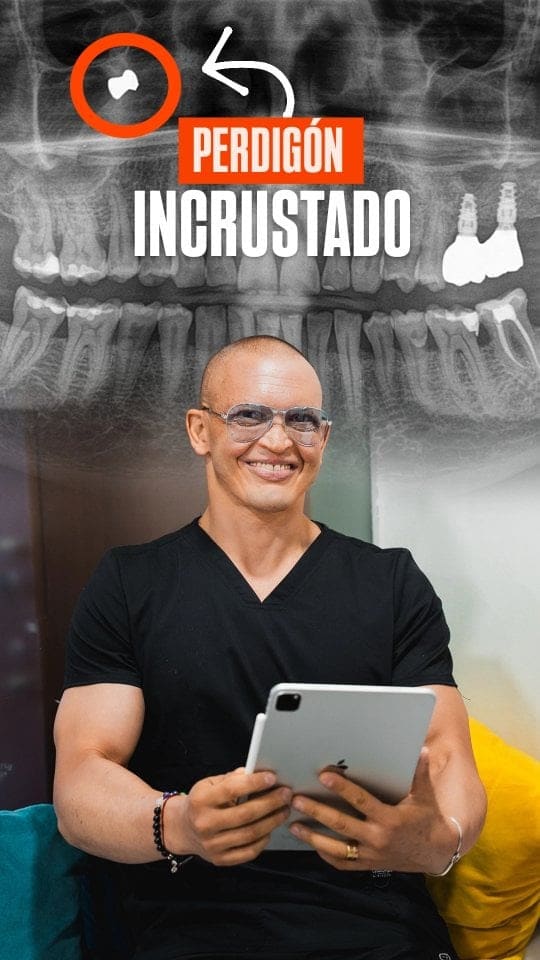 Radiografía que muestra un perdigón incrustado y el Dr. Matías San Martín